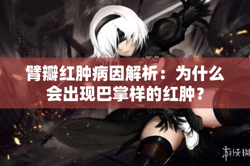 臂瓣紅腫病因解析：為什么會出現(xiàn)巴掌樣的紅腫？